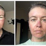 How GLOW Peptides Create A Multi-Pathway Approach To Skin Health