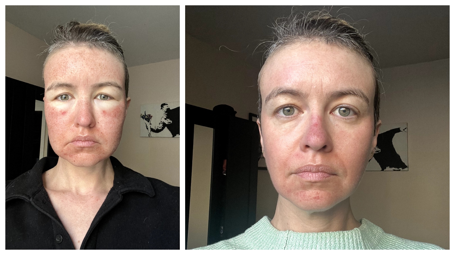 How GLOW Peptides Create A Multi-Pathway Approach To Skin Health